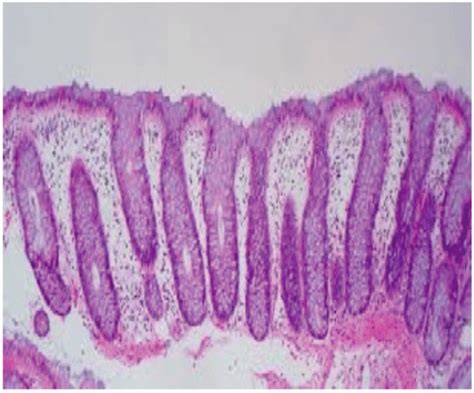 Photomicrograph Showing Normal Colon Biopsy Hande X10x Download Scientific Diagram