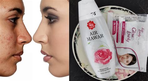 Begini Cara Yang Benar Menggunakan Air Mawar Viva Dan Fair N Lovely