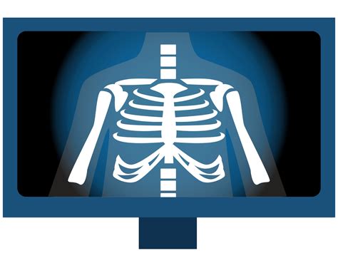 bone-scan2 - CV Primary Care & Walk-in Clinic