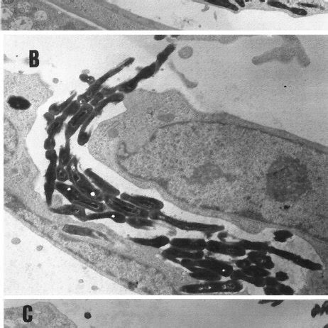 Morphologic Appearance Of M Abscessus R Left And M Abscessus S