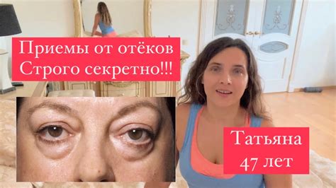 Приемы от утренних отёков - YouTube