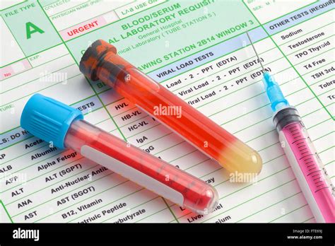 Blood vials hi-res stock photography and images - Alamy