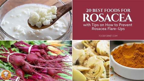 20 Best Foods For Rosacea With Tips On How To Prevent Rosacea Flare Ups