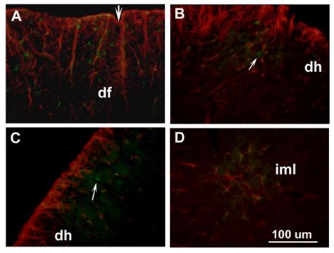 Double Immunofluorescence For MIF And GFAP In The Lumbosacral Spinal