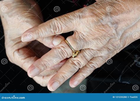 Elderly Woman Try To Remove Stuck Ring Off a Swollen Finger Stock Photo ...