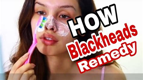 Clearing Blackheads With Toothpaste Did U Know Youtube