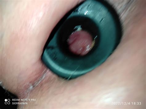 Sissy Pussy Tunnelplug Wide Open Pics XHamster