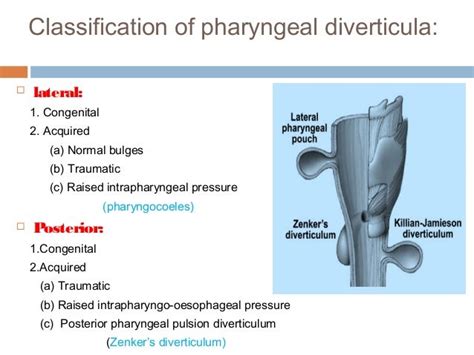 Pharyngeal pouches