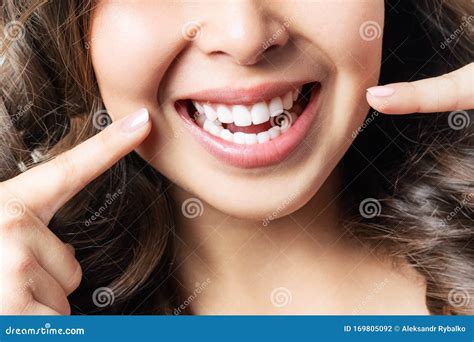 Dente Saud Vel E Perfeito Sorriso De Uma Jovem Branqueamento De Dentes