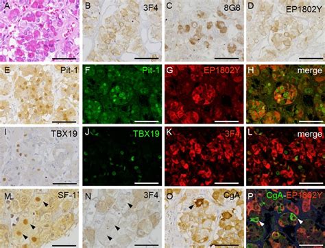 Cellular Distribution Of Prion Proteins PrP In The Pituitary Gland