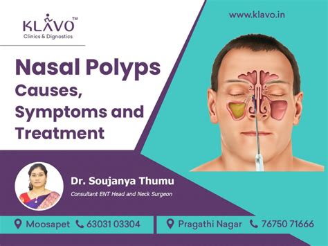 Nasal Polyps Treatment In Hyderabad Klavo Clinics