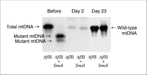 Elimination Of Mutant Mtdna And Repopulation By Wildtype Mtdna After