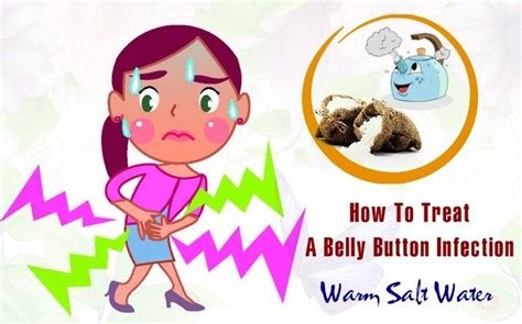 22 Typical Ways On How To Treat A Belly Button Infection At Home Page 2