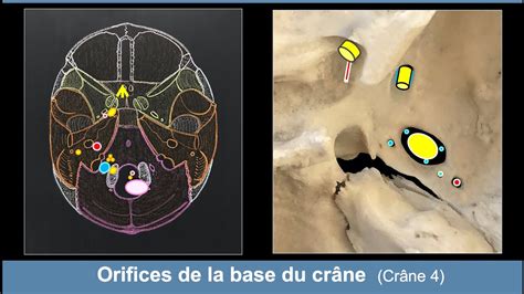 Anatomie Des Orifices De La Base Du Cr Ne Ost Ologie Du Cr Ne Youtube