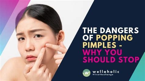 The Dangers Of Popping Pimples Why You Should Stop