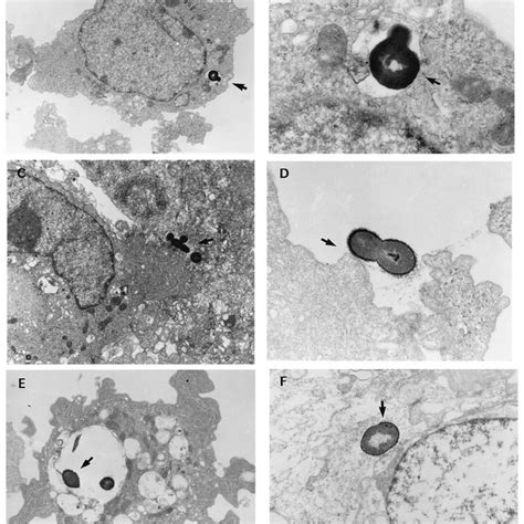 Electron Micrographs Showing Penetration Of A Cells By Pneumococci