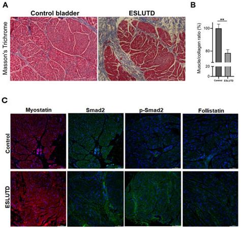 Ijms Free Full Text Myostatin Overexpression And Smad Pathway In