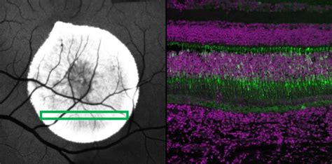 Subretinal Injection Image Eurekalert Science News Releases