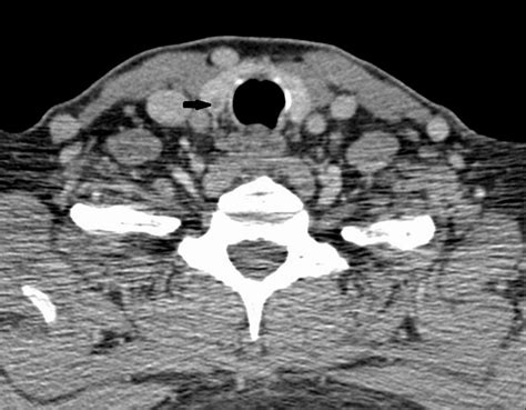 Essentials Of Parathyroid Imaging Operative Techniques In