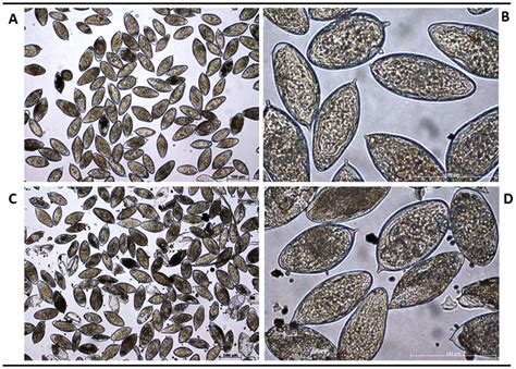 Schistosoma Mansoni Egg Labeled