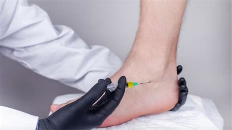 Achilles Tendon Injury: Symptoms, Diagnosis & Treatment - Travocure