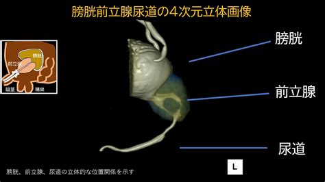 あなたの排尿障害はどこから？ 前立腺？ Youtube