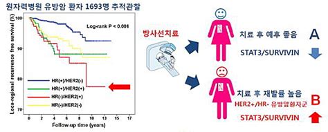 유방암 환자 방사선 치료 결과 사전예측도 가능