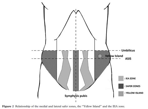 The Risk Of Injury To Inferior Epigastric Artery Iea Subjects During