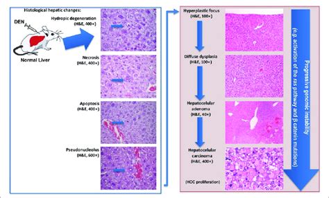 The Sequences Of The Main Events In Den Induced Liver Tumors In Mice