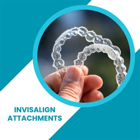 Invisalign Attachments What Are They Do I Need Them