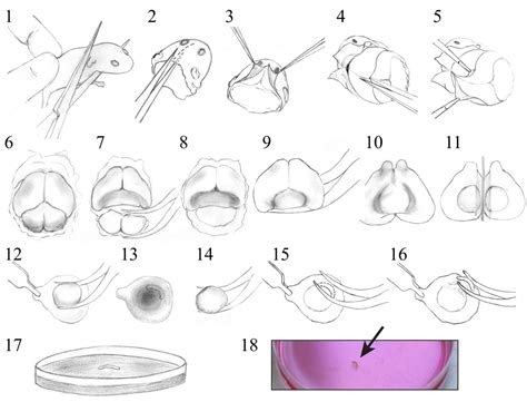 Sex Differences In Mouse Hippocampal Astrocytes After In Vitro Ischemia Scientific Article