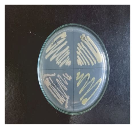 Subculture Colony Of Actinomycetes A Starch Casein Agar Sca Plate