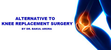 Alternative To Knee Replacement Surgery Dr Bakul Arora