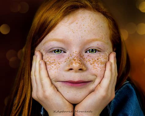 Taches De Rousseur Freckle Face Freckles Face