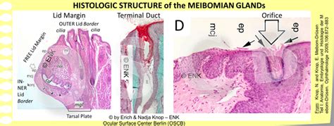 Meibomian Glands Histology