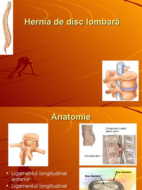 Pdf Hernia Disc Dokumen Tips