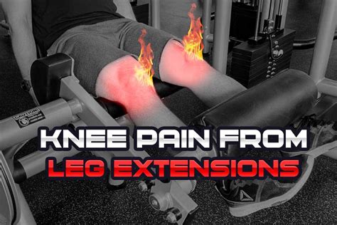 Negative Knee Extension