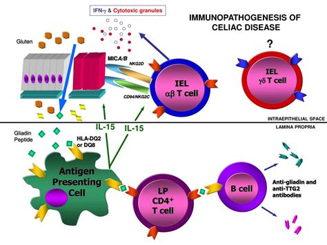 PPT The Role Of TCR Gamma Delta T Cells In Celiac Disease PowerPoint