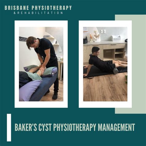 Baker's Cyst Physiotherapy Management - Brisbane Physiotherapy