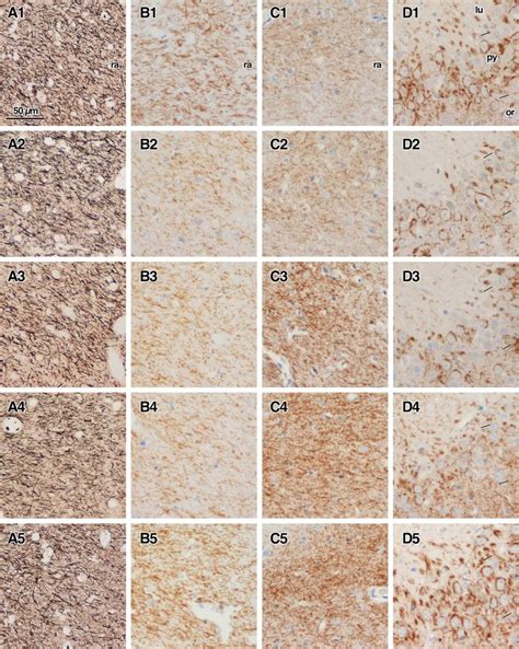 Photomicrographs of the CA3 region stained with the Gallyas method (A ... 