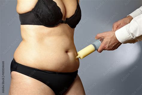 Rotund Woman Liposuction Belly Syringe Foto De Stock Adobe Stock