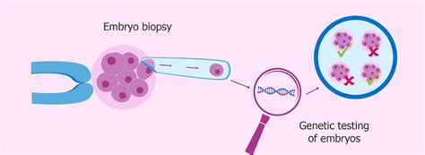 What Is Embryo Preimplantation Genetic Testing Pgt In Ivf