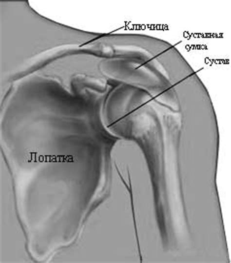 Бурсит: симптомы, диагностика, лечение
