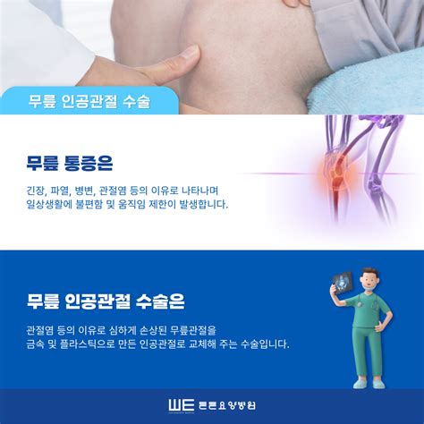 톱 872 무릎 인공 관절 수술 업데이트 29 일 전