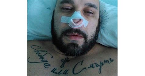 Разбиха носа на Мишо Шамара