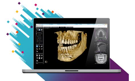 Cs 3d Imaging Software Hero Ivoclar Australia Equipment