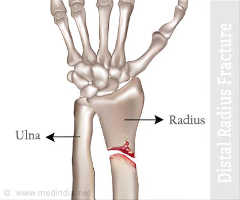 Distal Radius Anatomy Anatomy Reading Source