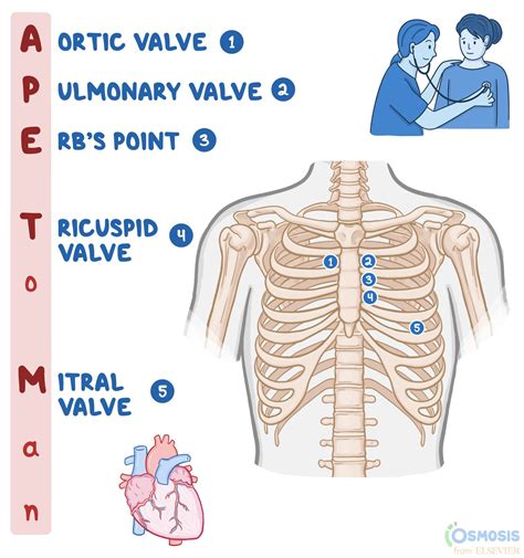 APE To Man: Heart Sounds Mnemonic | Osmosis | Heart sounds, Airway ...