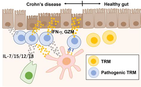 Unique Tissue Resident Memory Cd4 T Cells In Crohns Disease Takeda G