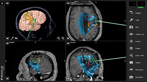 Frontiers Challenges And Opportunities Of Intraoperative 3d